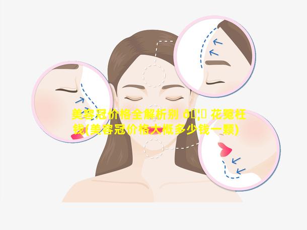 美容冠价格全解析别 🦊 花冤枉钱(美容冠价格大概多少钱一颗)